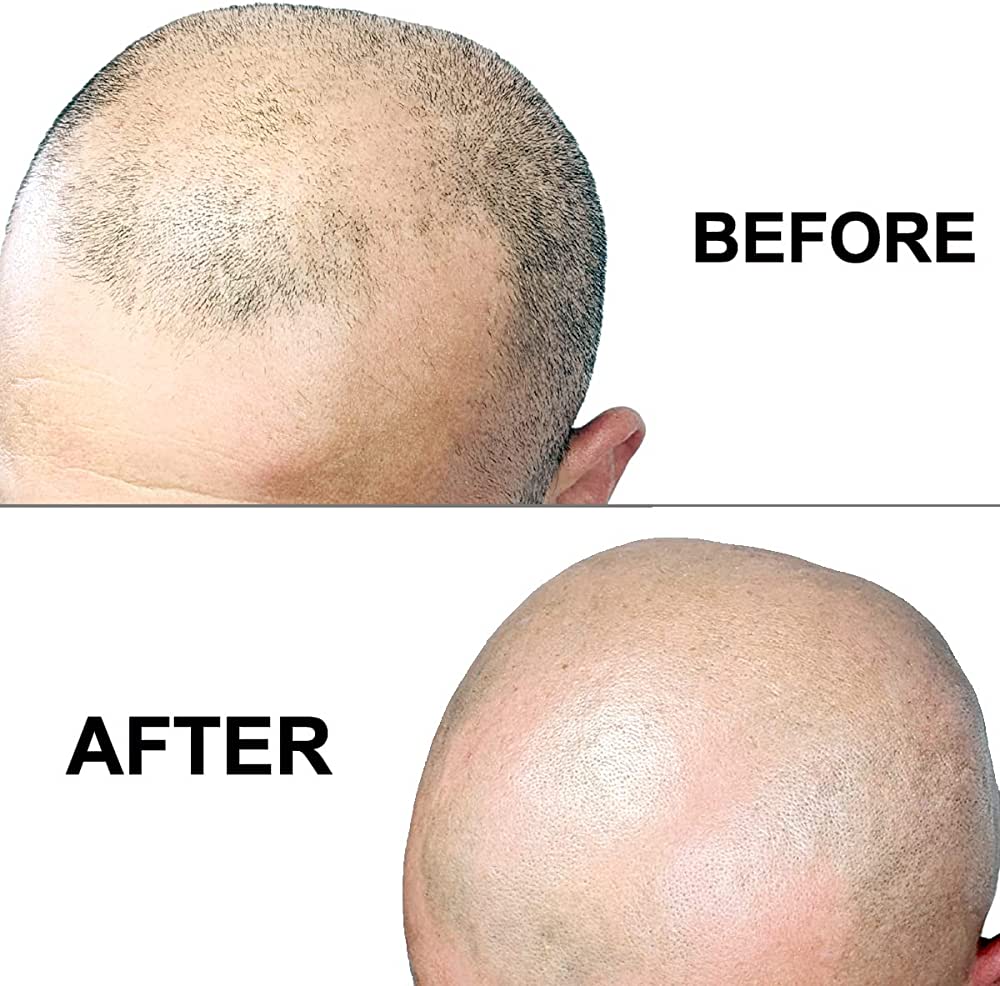 Head Shaving: Why You Should Consider It | Vablee™ Guide