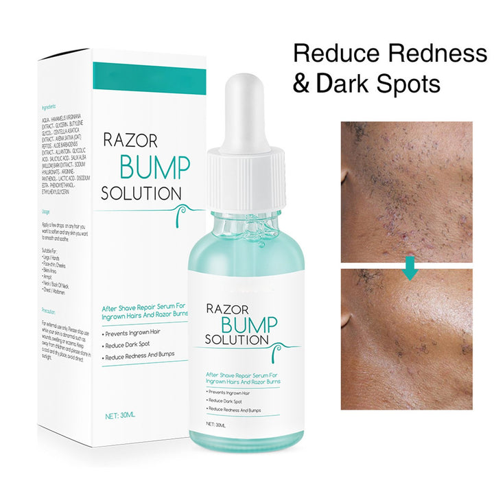 Vablee™ After Shave Serum Razor Bump Solution - Say goodbye to razor bumps and irritated skin with our Razor Bumps Solution. Our natural plant extracts gently moisturize and repair your skin, leaving it soothed, delicate, and smooth. This gentle and moisturizing formula not only cools down inflammation but also prevents future occurrences of razor bumps.