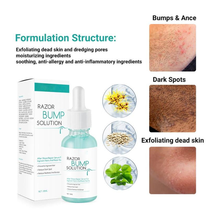 Vablee™ After Shave Serum Razor Bump Solution - Say goodbye to razor bumps and irritated skin with our Razor Bumps Solution. Our natural plant extracts gently moisturize and repair your skin, leaving it soothed, delicate, and smooth. This gentle and moisturizing formula not only cools down inflammation but also prevents future occurrences of razor bumps.