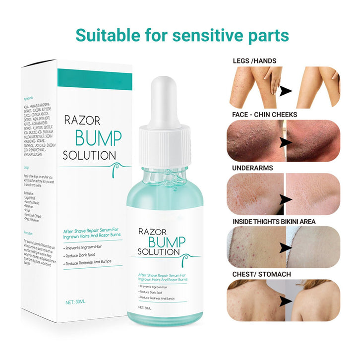 Vablee™ After Shave Serum Razor Bump Solution - Say goodbye to razor bumps and irritated skin with our Razor Bumps Solution. Our natural plant extracts gently moisturize and repair your skin, leaving it soothed, delicate, and smooth. This gentle and moisturizing formula not only cools down inflammation but also prevents future occurrences of razor bumps.